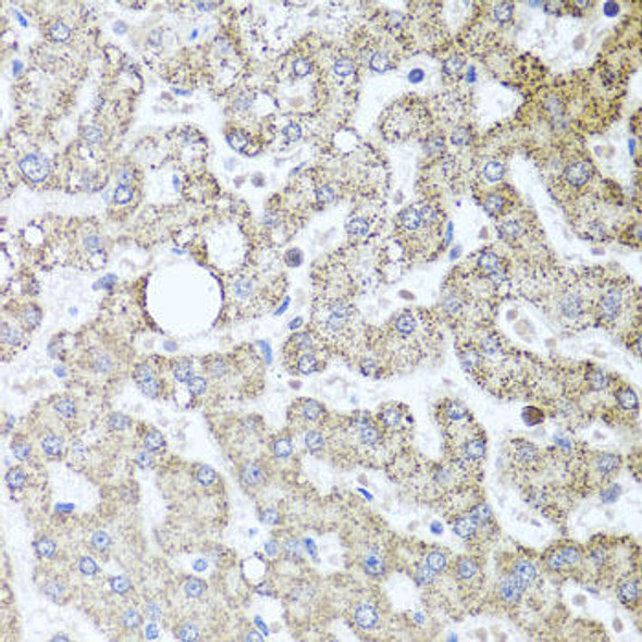 Cell Cycle Antibodies 1 Anti-TSG101 Antibody CAB1692