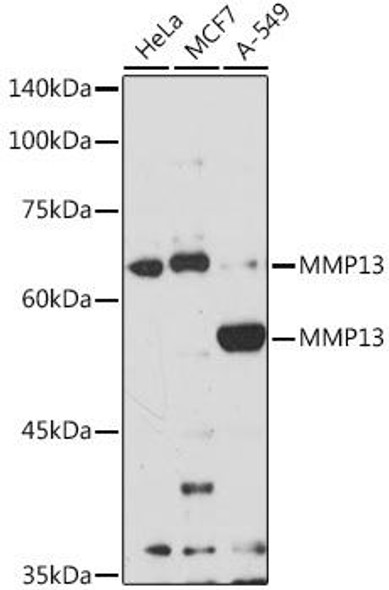 KO Validated Antibodies 1 Anti-MMP13 Antibody CAB16920KO Validated