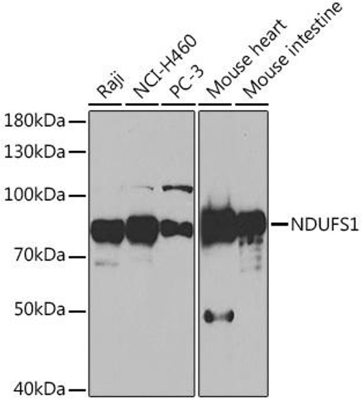 Cell Biology Antibodies 7 Anti-NDUFS1 Antibody CAB16926