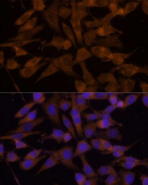 Metabolism Antibodies 2 Anti-UGT2B7 Antibody CAB1693