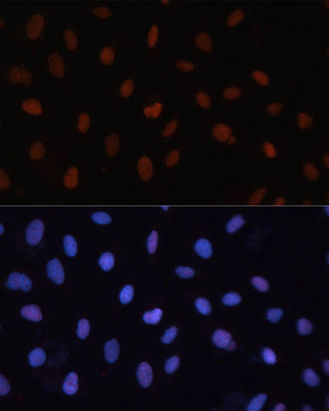 Cell Cycle Antibodies 1 Anti-RB Antibody CAB16966