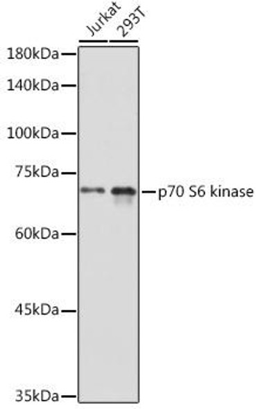 Cell Death Antibodies 1 Anti-p70 S6 kinase Antibody CAB16968