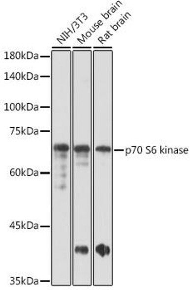 Cell Death Antibodies 1 Anti-p70 S6 kinase Antibody CAB16968