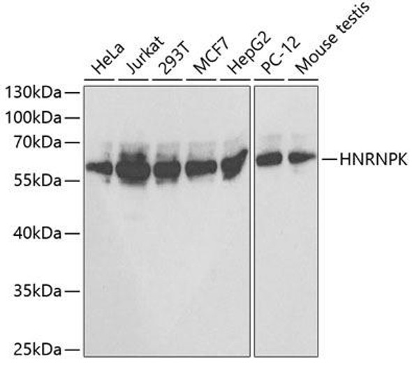 Immunology Antibodies 2 Anti-HNRNPK Antibody CAB1701