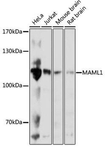 Signal Transduction Antibodies 2 Anti-MAML1 Antibody CAB17060