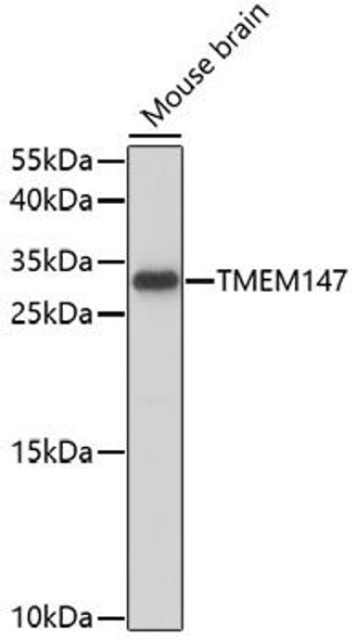 Cell Biology Antibodies 7 Anti-TMEM147 Antibody CAB17076