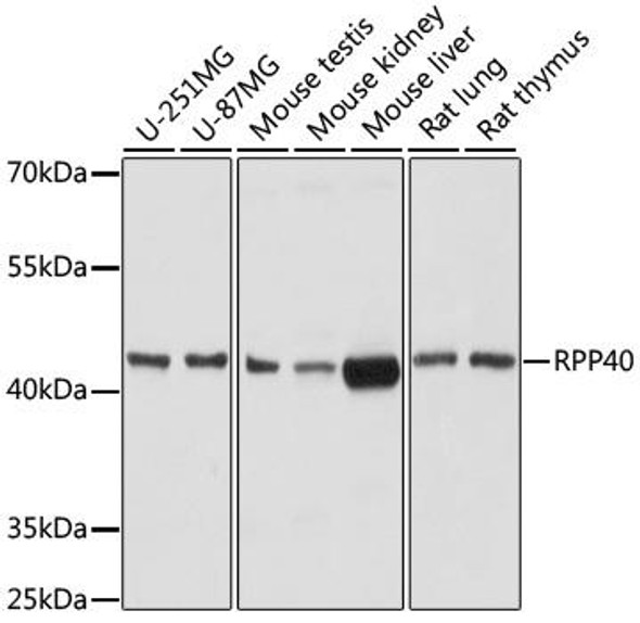 Epigenetics and Nuclear Signaling Antibodies 3 Anti-RPP40 Antibody CAB17086