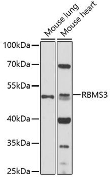 Cell Biology Antibodies 7 Anti-RBMS3 Antibody CAB17142