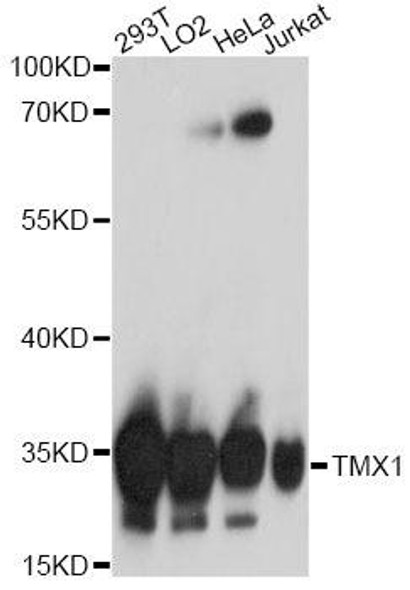 Cell Biology Antibodies 7 Anti-TMX1 Antibody CAB17219