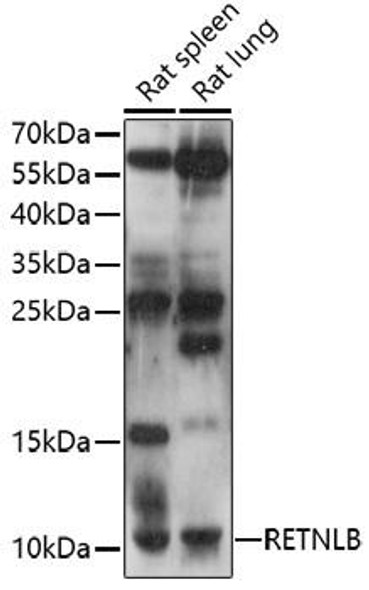 Cell Biology Antibodies 7 Anti-RETNLB Antibody CAB17227