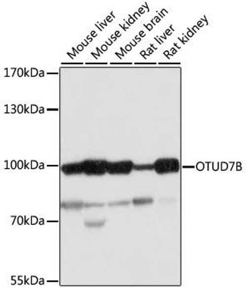 Immunology Antibodies 2 Anti-OTUD7B Antibody CAB17329
