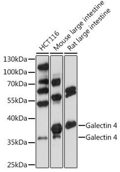 Cell Biology Antibodies 7 Anti-Galectin 4 Antibody CAB17417