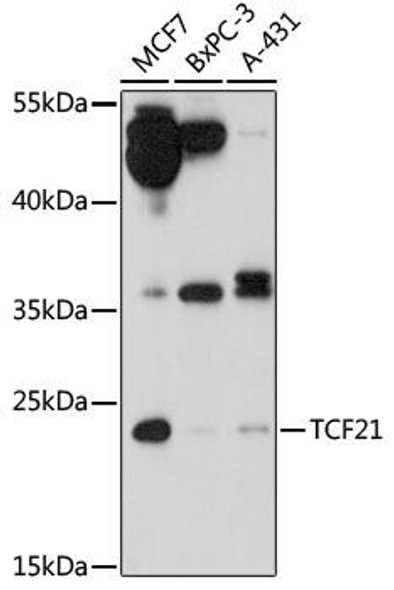 Epigenetics and Nuclear Signaling Antibodies 3 Anti-TCF21 Antibody CAB17451