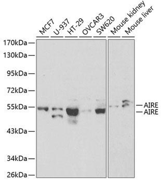 Epigenetics and Nuclear Signaling Antibodies 3 Anti-AIRE Antibody CAB1767