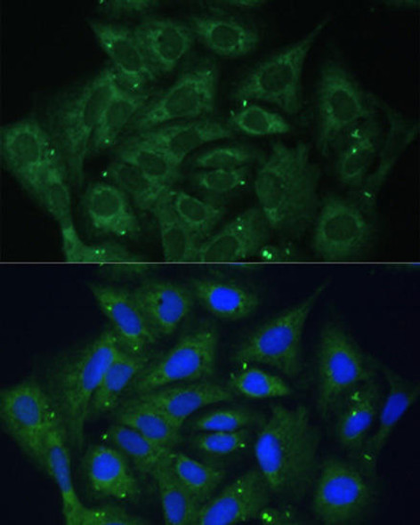 Epigenetics and Nuclear Signaling Antibodies 3 Anti-IGF2BP2 Antibody CAB1774