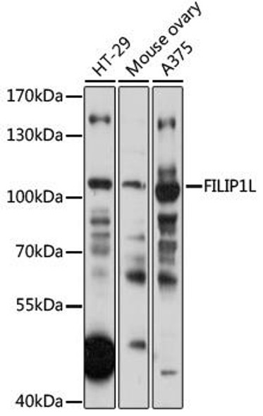 Cardiovascular Antibodies Anti-FILIP1L Antibody CAB17861