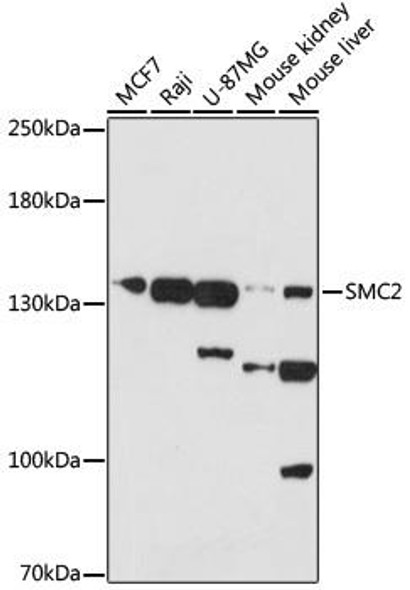 Cell Cycle Antibodies 1 Anti-SMC2 Antibody CAB17867