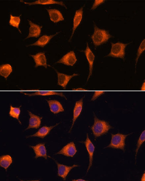 Cell Biology Antibodies 7 Anti-GBAS Antibody CAB17888