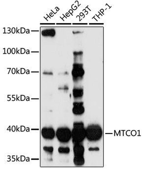 Cell Biology Antibodies 7 Anti-MTCO1 Antibody CAB17889