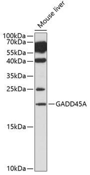 Cell Cycle Antibodies 1 Anti-GADD45A Antibody CAB1797