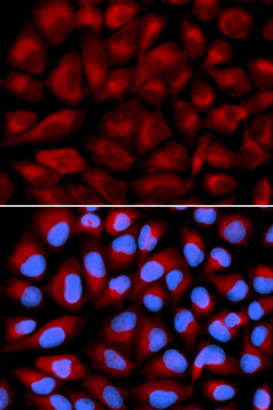 Epigenetics and Nuclear Signaling Antibodies 3 Anti-FANCC Antibody CAB1812