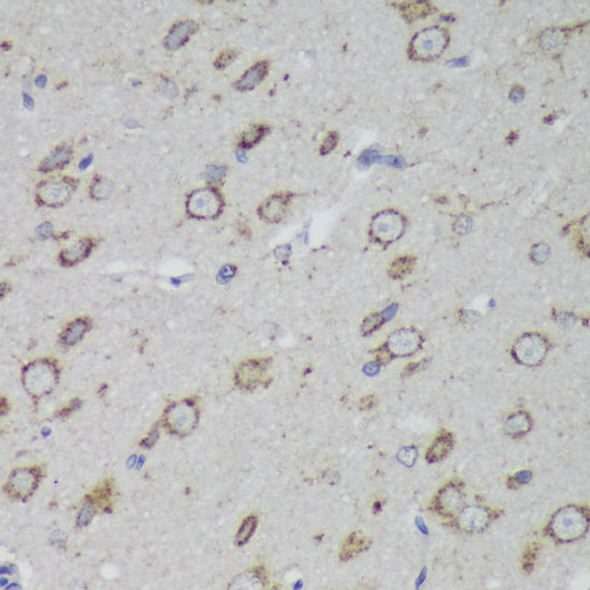 Metabolism Antibodies 2 Anti-PSAP Antibody CAB1819