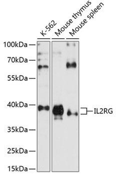 Immunology Antibodies 2 Anti-IL-2RG Antibody CAB1829