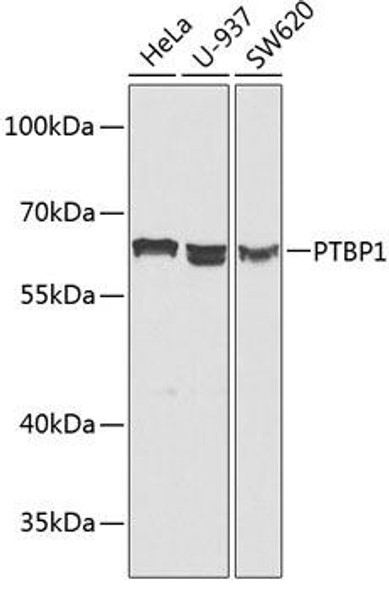 Epigenetics and Nuclear Signaling Antibodies 3 Anti-PTBP1 Antibody CAB1831