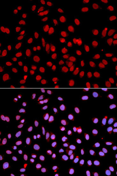 Epigenetics and Nuclear Signaling Antibodies 3 Anti-POLR2J Antibody CAB1843