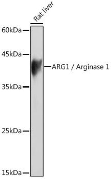 Immunology Antibodies 2 Anti-ARG1 / Arginase 1 Antibody CAB1847