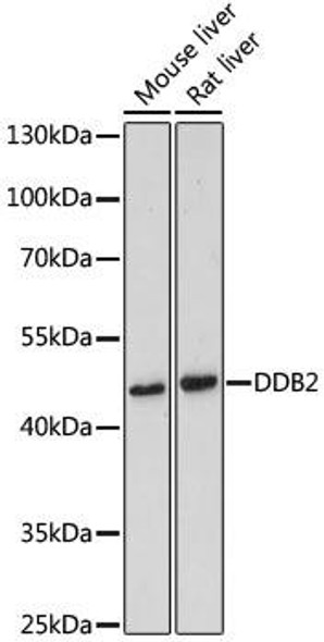 Epigenetics and Nuclear Signaling Antibodies 3 Anti-DDB2 Antibody CAB1848