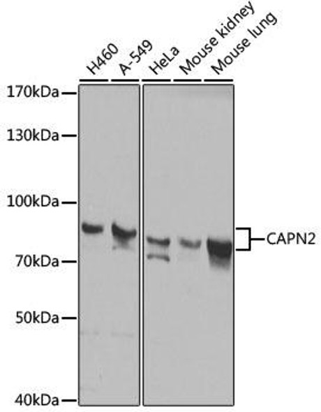 KO Validated Antibodies 1 Anti-CAPN2 Antibody CAB1861KO Validated