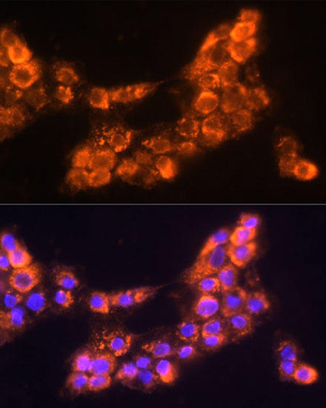 Cell Biology Antibodies 7 Anti-LAMC2 Antibody CAB1869