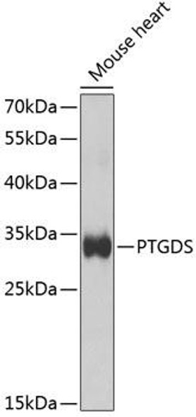 Metabolism Antibodies 2 Anti-PTGDS Antibody CAB1889