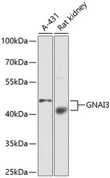 Cell Cycle Antibodies 1 Anti-GNAI3 Antibody CAB1922