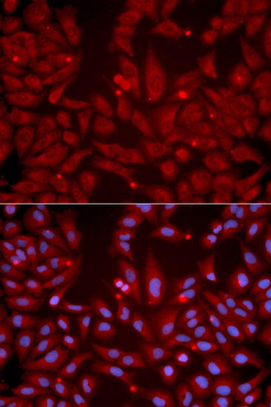 Signal Transduction Antibodies 2 Anti-GRIK2 Antibody CAB1939