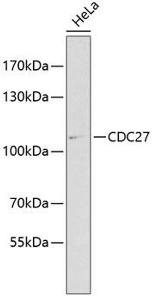 Signal Transduction Antibodies 2 Anti-CDC27 Antibody CAB1954