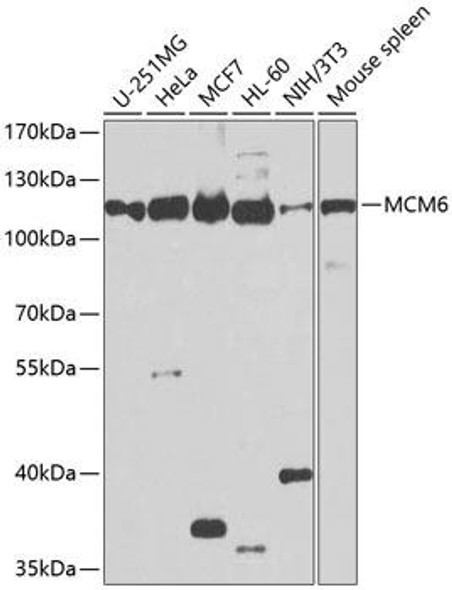 Cell Cycle Antibodies 1 Anti-MCM6 Antibody CAB1955