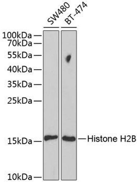 KO Validated Antibodies 1 Anti-Histone H2B Antibody CAB1958KO Validated