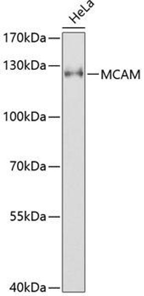 Cell Biology Antibodies 8 Anti-MCAM Antibody CAB1962