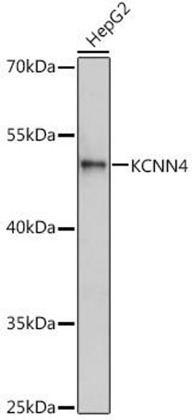 Immunology Antibodies 2 Anti-KCNN4 Antibody CAB1974