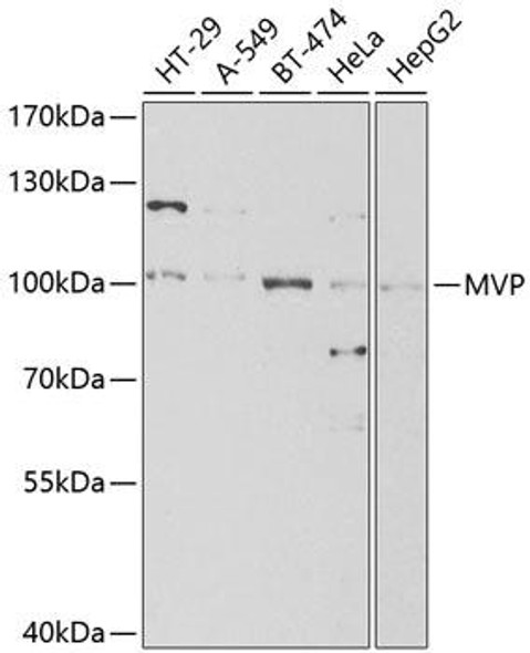 Epigenetics and Nuclear Signaling Antibodies 3 Anti-MVP Antibody CAB1980