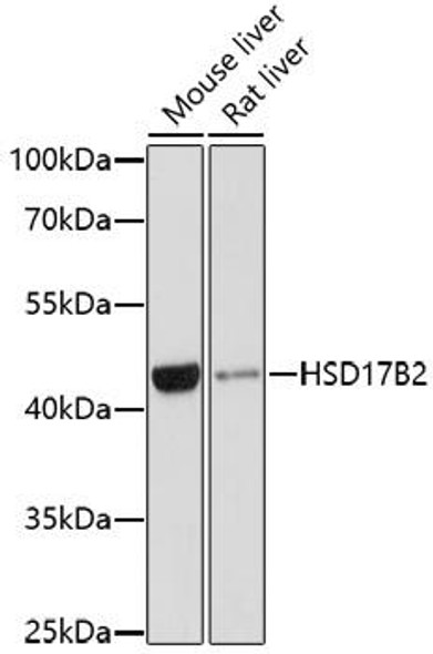 Metabolism Antibodies 2 Anti-HSD17B2 Antibody CAB1983