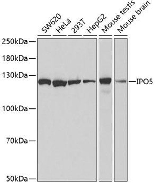 Immunology Antibodies 2 Anti-IPO5 Antibody CAB1984