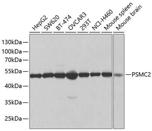 Immunology Antibodies 2 Anti-PSMC2 Antibody CAB1985