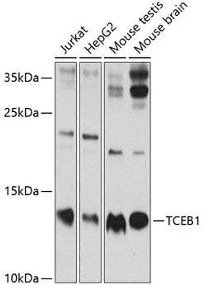 Immunology Antibodies 2 Anti-TCEB1 Antibody CAB1989