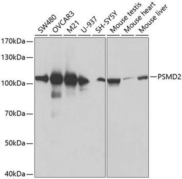 Cell Biology Antibodies 8 Anti-PSMD2 Antibody CAB1999