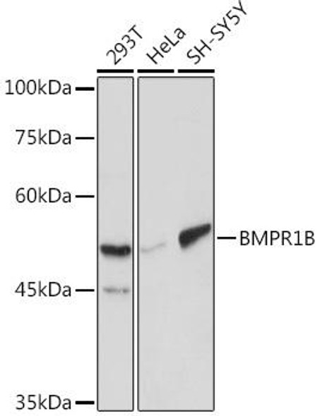 Cell Biology Antibodies 8 Anti-BMPR1B Antibody CAB2005