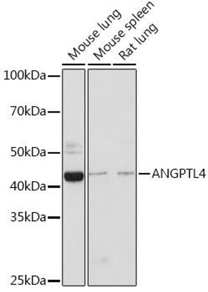 Cardiovascular Antibodies Anti-ANGPTL4 Antibody CAB2011