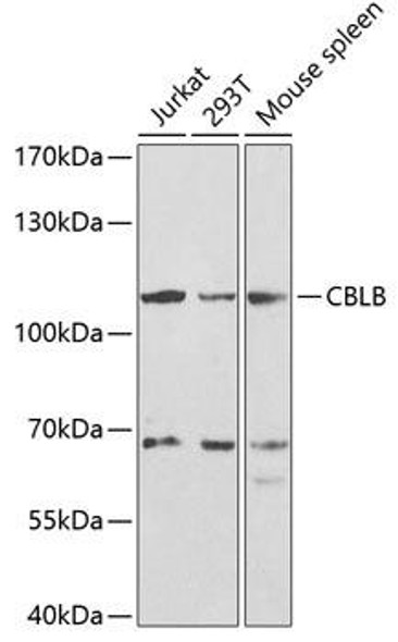 Signal Transduction Antibodies 2 Anti-CBLB Antibody CAB2014